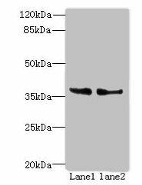 POLR3F Antibody (PACO41894)