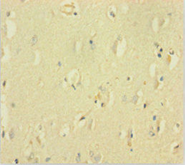 GABRQ Antibody (PACO42394)