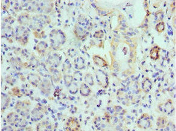 EPM2A Antibody (PACO42914)