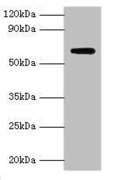 AMHR2 Antibody (PACO43062)