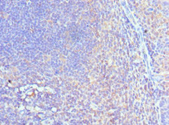 CUL5 Antibody (PACO43068)