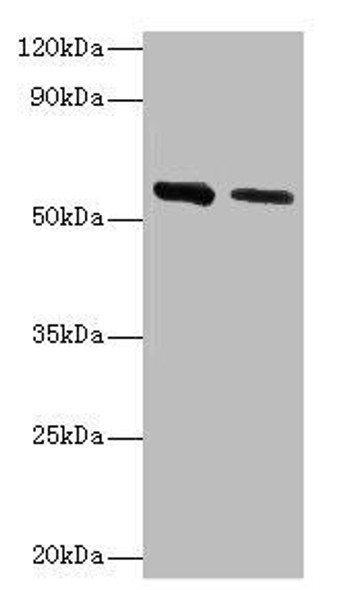 ADSL Antibody (PACO43127)