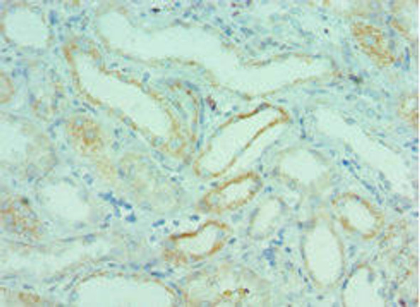 BRD9 Antibody (PACO43204)