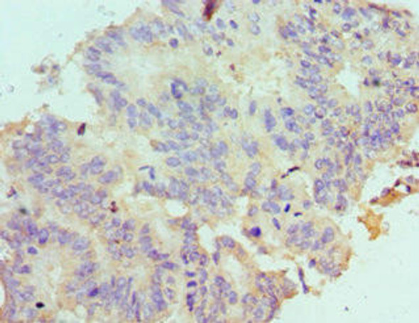 LDLRAP1 Antibody (PACO43246)