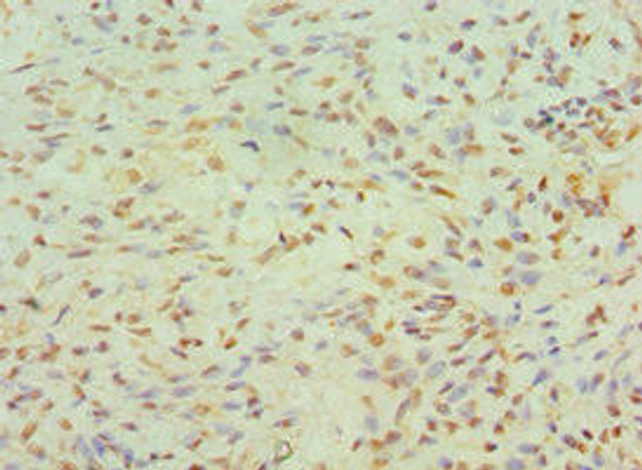 JMJD6 Antibody (PACO43295)