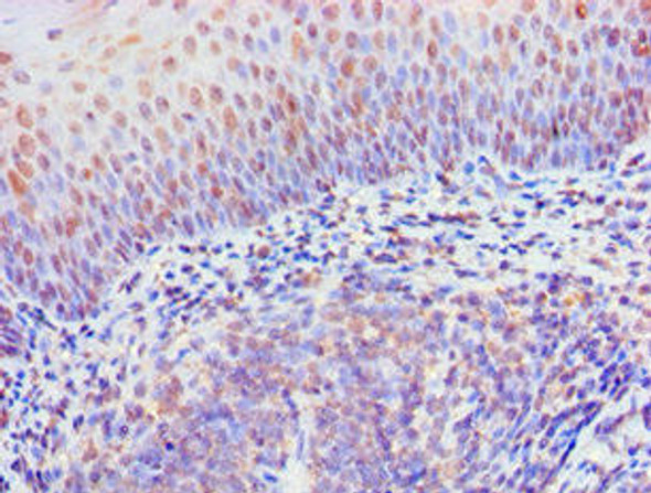 RIPK3 Antibody (PACO43475)