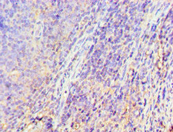 GRK6 Antibody (PACO43519)