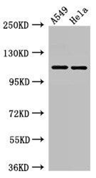 EPHA5 Antibody (PACO49574)