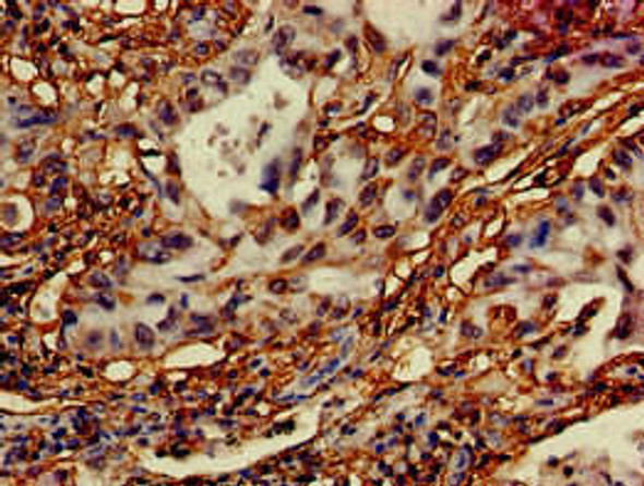 DRAM1 Antibody (PACO50830)