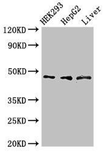 ACADSB Antibody (PACO51294)