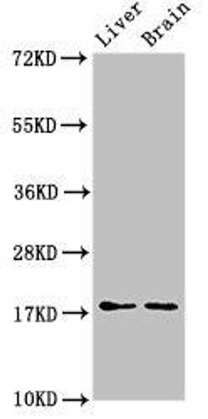 HSPB6 Antibody (PACO51618)