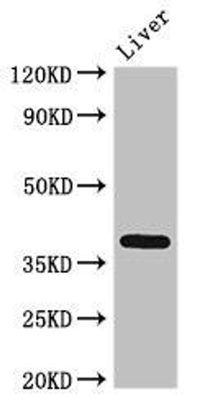 ETV7 Antibody (PACO52938)