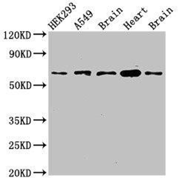 PXK Antibody (PACO53122)