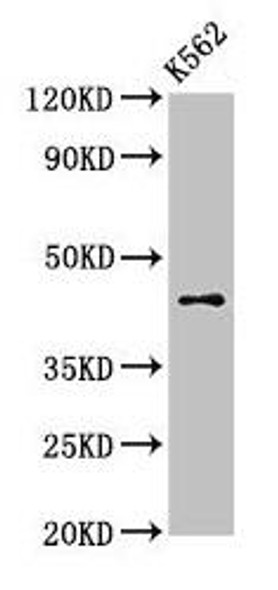 AGPAT3 Antibody (PACO53170)