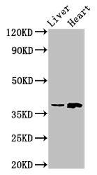 ACMSD Antibody (PACO53530)