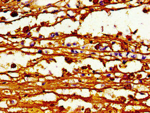 ABCB4 Antibody (PACO54602)