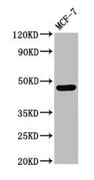 CASQ2 Antibody (PACO54674)