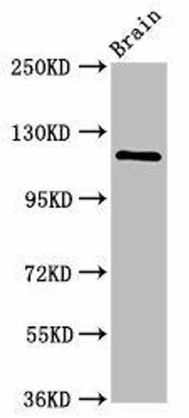 HIP1R Antibody (PACO56828)