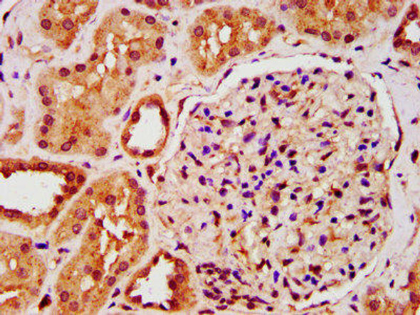 IST1 Antibody (PACO57828)