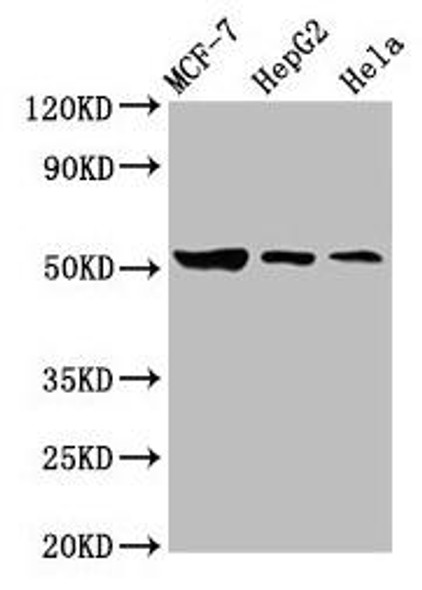 GBA Antibody (PACO58765)