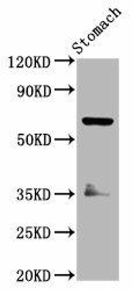 SLC5A5 Antibody (PACO59273)
