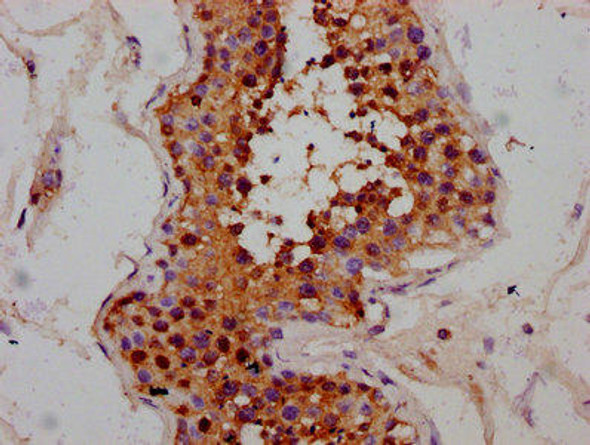 MEX3B Antibody (PACO60148)