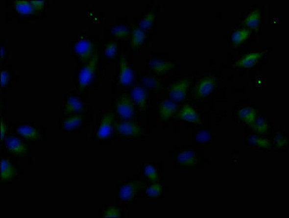 MST1R Antibody (PACO61951)