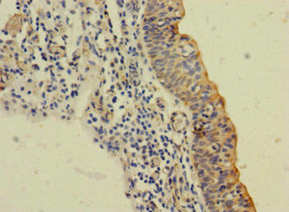 SLC6A15 Antibody (PACO41326)