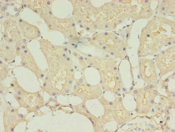 TMEM27 Antibody (PACO41666)