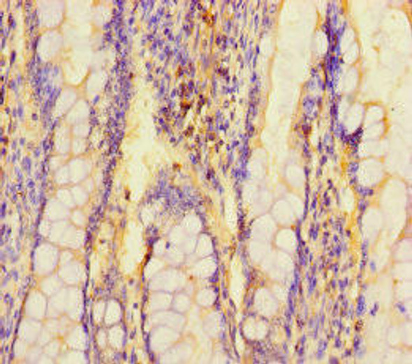 ARL15 Antibody (PACO41738)