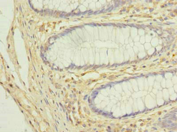 COX11 Antibody (PACO42714)