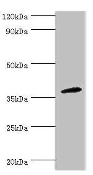 CD200R1 Antibody (PACO44146)