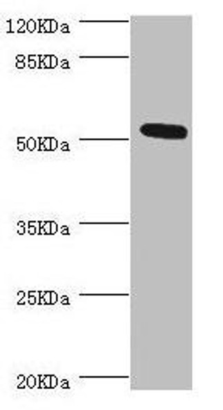 ZC3HC1 Antibody (PACO44249)