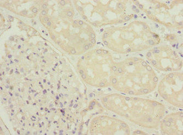 ZFYVE16 Antibody (PACO44820)