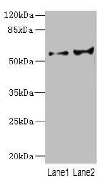 CYP2C18 Antibody (PACO44825)