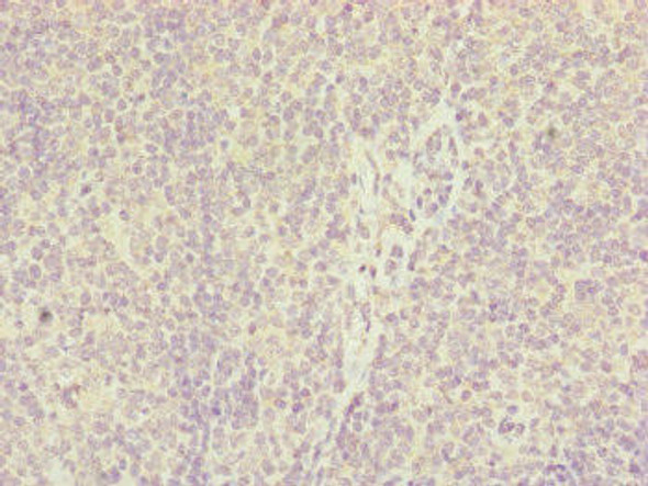IL36A Antibody (PACO45087)