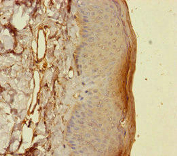 S100A14 Antibody (PACO45624)