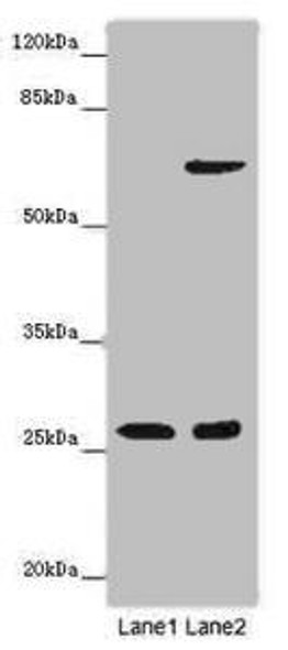 SOX14 Antibody (PACO46222)