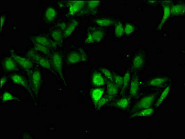 HOXD12 Antibody (PACO49662)