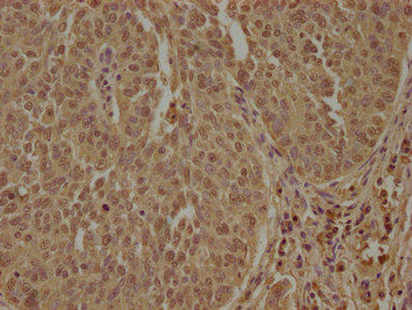 PPP1R13L Antibody (PACO63475)