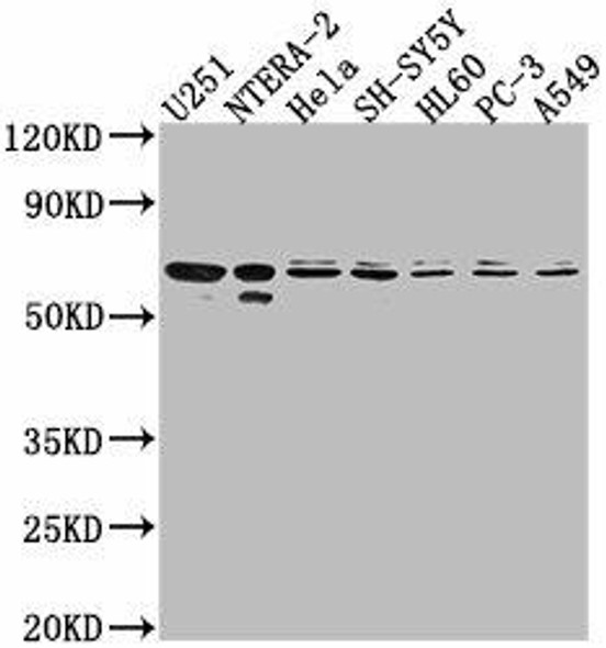 CDK17 Antibody (PACO63747)