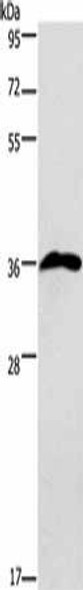 PRPS1/PRPS2/PRPS1L1 Antibody (PACO18614)