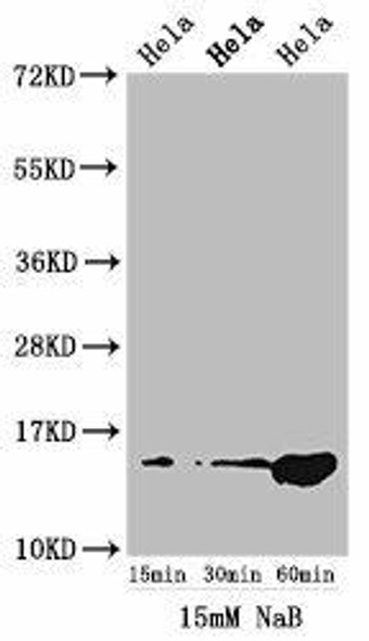 Acetyl-HIST1H2AG (K5) Antibody (PACO56499)