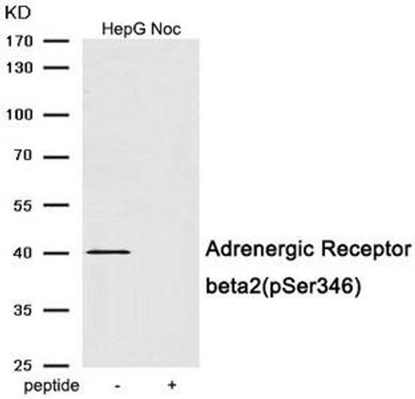 Phospho-ADRB2 (Ser346) Antibody (PACO24056)