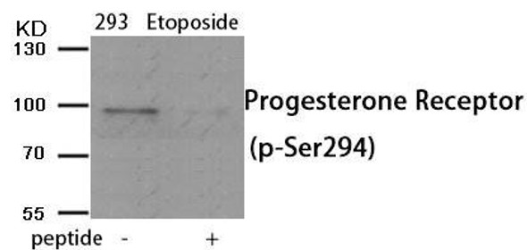 Phospho-PGR (Ser294) Antibody (PACO24074)
