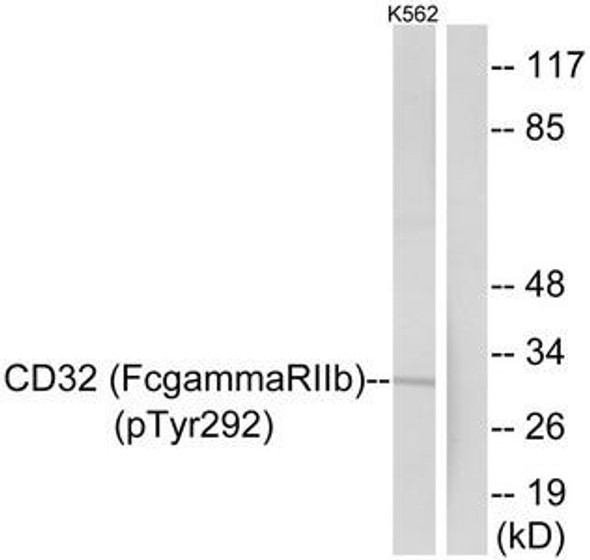 Phospho-FCGR2B (Tyr292) Antibody (PACO24088)