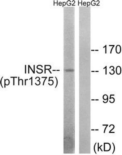 Phospho-INSR (Thr1375) Antibody (PACO24188)