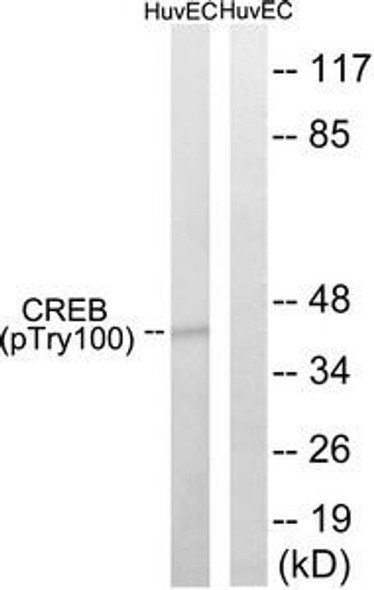 Phospho-CREB1 (Thr100) Antibody (PACO24202)