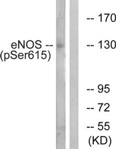 Phospho-NOS3 (Ser615) Antibody (PACO24205)