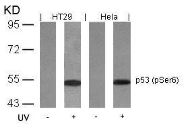 Phospho-TP53 (Ser6) Antibody (PACO24258)